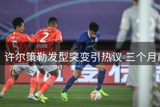 许尔策勒发型突变引热议 三个月前浓密秀发如今消失